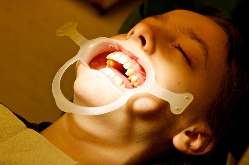 funny-dentist-braces-picture